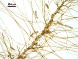 6 – Tricoblasti fertili con spermatocisti